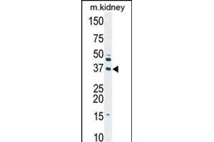 Western blot analysis of anti-DGUOK Pab (ABIN391122 and ABIN2841249) in mouse kidney tissue lysate (35 μg/lane).