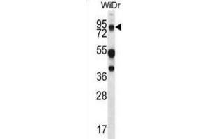 Western Blotting (WB) image for anti-Mucin 20, Cell Surface Associated (MUC20) antibody (ABIN2995266) (MUC20 antibody)