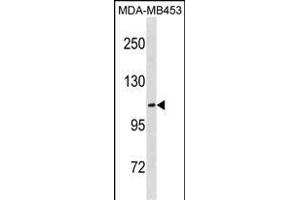 EN Antibody (C-term) (ABIN1881297 and ABIN2838760) western blot analysis in MDA-M cell line lysates (35 μg/lane). (ENPP3 antibody  (C-Term))