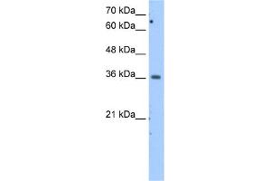 WB Suggested Anti-MDH1 Antibody Titration:  2. (MDH1 antibody  (Middle Region))