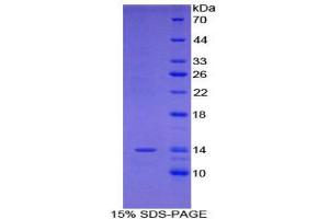 SDS-PAGE (SDS) image for R-Spondin 1 (RSPO1) (AA 21-135) protein (His tag) (ABIN1878272) (RSPO1 Protein (AA 21-135) (His tag))