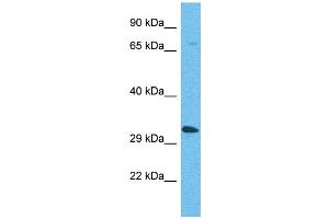 Western Blotting (WB) image for anti-Olfactory Receptor, Family 5, Subfamily AP, Member 2 (OR5AP2) (C-Term) antibody (ABIN2791746) (OR5AP2 antibody  (C-Term))