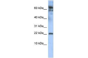 WB Suggested Anti-LDOC1 Antibody Titration:  0. (LDOC1 antibody  (N-Term))