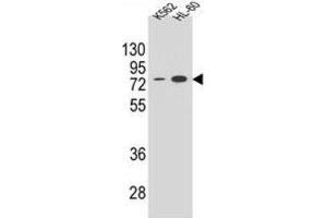 Western Blotting (WB) image for anti-Ectonucleoside Triphosphate diphosphohydrolase 3 (ENTPD3) antibody (ABIN2995799) (ENTPD3 antibody)