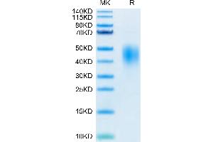 Biotinylated Human PD-L2 on Tris-Bis PAGE under reduced condition. (PDCD1LG2 Protein (AA 20-220) (His-Avi Tag,Biotin))