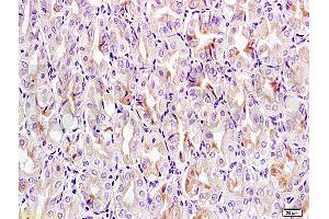 Formalin-fixed and paraffin embedded mouse stomach tissue labeled with Anti-CCL24 Polyclonal Antibody, Unconjugated (ABIN740925) at 1:200 followed by conjugation to the secondary antibody, (SP-0023), and DAB staining (CCL24 antibody  (AA 27-119))