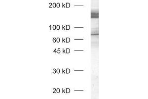 dilution: 1 : 1000, sample: rat brain honogenate (unboiled sample) (Neurexin 1 antibody  (AA 1328-1421))