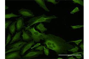 Immunofluorescence of purified MaxPab antibody to CAP1 on HeLa cell. (CAP1 antibody  (AA 1-475))