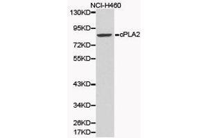 Western Blotting (WB) image for anti-Phospholipase A2, Group IVA (Cytosolic, Calcium-Dependent) (PLA2G4A) antibody (ABIN1874154) (PLA2G4A antibody)