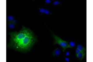 Anti-CD80 mouse monoclonal antibody (ABIN2452897) immunofluorescent staining of COS7 cells transiently transfected by pCMV6-ENTRY CD80 (RC206540). (CD80 antibody)