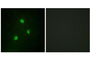 Immunofluorescence analysis of A549 cells, using TBX1 antibody.
