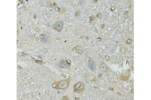 Immunohistochemistry of paraffin-embedded Mouse brain using CRYM Polyclonal Antibody at dilution of 1:100 (40x lens). (CRYM antibody)