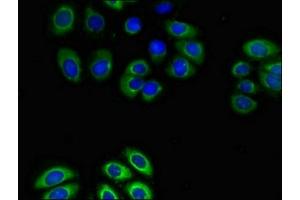 Immunofluorescent analysis of A549 cells using ABIN7153347 at dilution of 1:100 and Alexa Fluor 488-congugated AffiniPure Goat Anti-Rabbit IgG(H+L) (GPR4 antibody  (AA 285-362))