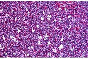 Human Tonsil: Formalin-Fixed, Paraffin-Embedded (FFPE) (RGS3 antibody  (AA 1-193))
