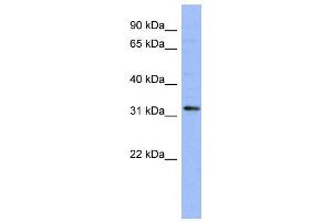 WB Suggested Anti-TLX1  Antibody Titration: 0. (TLX1 antibody  (N-Term))