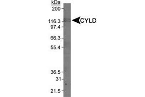 Western blot analysis of CYLD in Jurkat whole cell extract using CYLD polyclonal antibody . (CYLD antibody  (AA 500-600))