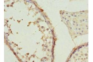 Immunohistochemistry of paraffin-embedded human testis tissue using ABIN7171416 at dilution of 1:100 (CCT2 antibody  (AA 206-535))