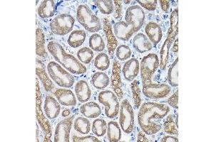 Immunohistochemistry of paraffin-embedded rat testis using PIWIL4 Rabbit pAb (ABIN6132982, ABIN6145704, ABIN6145705 and ABIN6217111) at dilution of 1:100 (40x lens). (PIWIL4 antibody  (AA 260-460))