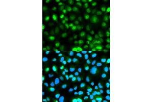 Immunofluorescence analysis of HeLa cells using ATXN3 antibody (ABIN6290080).
