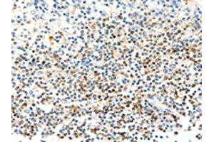 The image on the left is immunohistochemistry of paraffin-embedded Human tonsil tissue using ABIN7129442(FAM3A Antibody) at dilution 1/25, on the right is treated with fusion protein. (FAM3A antibody)