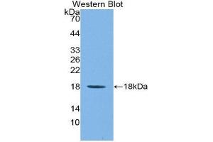 Figure. (IL1F9 antibody  (AA 5-149))