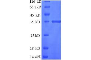 SDS-PAGE (SDS) image for CD81 (CD81) (AA 116-201), (Extracellular) protein (GST tag) (ABIN5709251)
