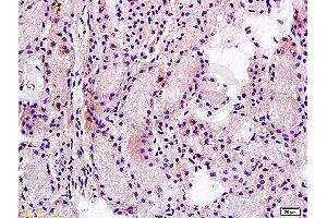 Formalin-fixed and paraffin embedded rat kidney tissue labeled Anti-MRP1 Polyclonal Antibody, Unconjugated (ABIN671526) at 1:200, followed by conjugation to the secondary antibody and DAB staining (MRP1 antibody  (AA 501-600))