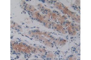 IHC-P analysis of stomach tissue, with DAB staining.