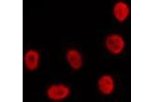 ABIN6274310 staining LOVO by IF/ICC. (CDKL1 antibody  (C-Term))