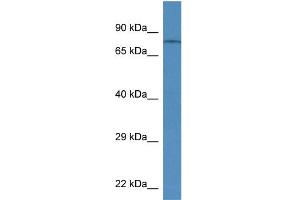 Trpv6 antibody - middle region  validated by WB using Rat Brain lysate at 1ug/ml. (TRPV6 antibody  (Middle Region))