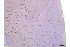 Formalin-fixed and paraffin embedded rat brain labeled with Anti-Glutamine PRPP amidotransferase Polyclonal Antibody, Unconjugated (ABIN872980) at 1:200 followed by conjugation to the secondary antibody and DAB staining (PPAT antibody  (AA 351-430))
