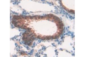 Figure. (Connexin 31 antibody  (AA 84-174))