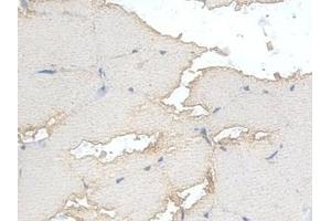 Immunohistochemistry (IHC) image for anti-phosphofructokinase, Muscle (PFKM) (AA 2-390) antibody (ABIN7435508)