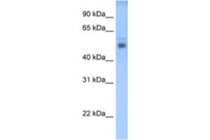 Western Blotting (WB) image for anti-STEAP Family Member 3, Metalloreductase (STEAP3) antibody (ABIN2462703)