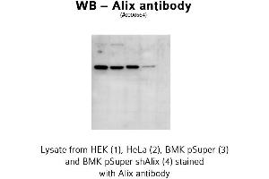 Image no. 2 for anti-Programmed Cell Death 6 Interacting Protein (PDCD6IP) antibody (ABIN347079) (ALIX antibody)