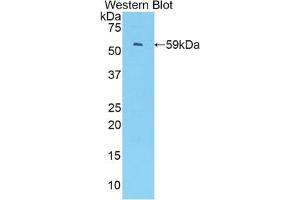 Detection of Recombinant IRF1, Mouse using Polyclonal Antibody to Interferon Regulatory Factor 1 (IRF1) (IRF1 antibody  (AA 44-319))