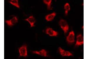 ABIN6269341 staining 293 by IF/ICC. (Acetyl-CoA Carboxylase alpha antibody  (N-Term))