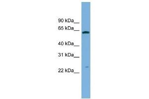 GSTA3 antibody used at 1 ug/ml to detect target protein.