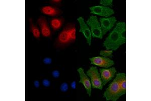 ABIN6263616 and ABIN6268641 staining HepG2 cells by IF/ICC. (NF-kB p65 antibody  (C-Term))