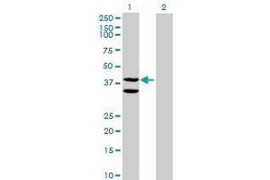 Lane 1: C21orf55 transfected lysate ( 38.