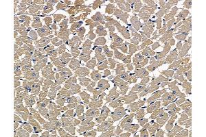 ABIN7097103 and ABIN7101170 at 1/100 staining rat heart tissue by IHC-P. (Dolichol Kinase antibody)