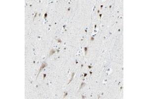 Immunohistochemical staining of human cerebral cortex with RDBP polyclonal antibody  shows strong nuclear positivity in neuronal cells at 1:200-1:500 dilution.