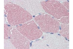 Human Skeletal Muscle: Formalin-Fixed, Paraffin-Embedded (FFPE) (STK39 antibody  (C-Term))