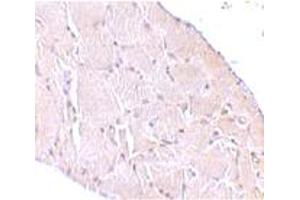 Immunohistochemical staining of human skeletal muscle tissue with 10 ug/mL WNT10A polyclonal antibody . (WNT10A antibody  (C-Term))