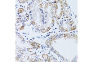 Immunohistochemistry of paraffin-embedded human stomach using DNAJC19 antibody (ABIN5972967) at dilution of 1/100 (40x lens).