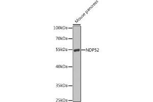 Western blot analysis of extracts of mouse pancreas, using NDP52 antibody (ABIN6131368, ABIN6137860, ABIN6137861 and ABIN6223210) at 1:1000 dilution. (CALCOCO2 antibody  (AA 137-446))