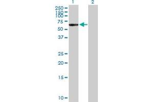 Western Blot analysis of CTNNA3 expression in transfected 293T cell line by CTNNA3 MaxPab polyclonal antibody. (CTNNA3 antibody  (AA 1-516))
