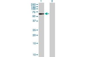 CTNNA3 antibody  (AA 1-516)