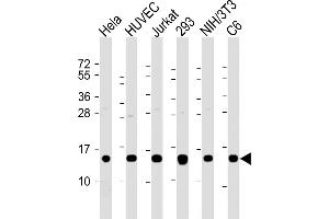 All lanes : Anti-Profilin-1 Antibody at 1:2000 dilution Lane 1: Hela whole cell lysate Lane 2: HUVEC whole cell lysate Lane 3: Jurkat whole cell lysate Lane 4: 293 whole cell lysate Lane 5: NIH/3T3 whole cell lysate Lane 6: C6 whole cell lysate Lysates/proteins at 20 μg per lane.
