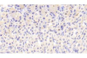 Detection of NT in Mouse Stomach Tissue using Polyclonal Antibody to Neurotensin (NT) (Neurotensin antibody  (AA 42-167))